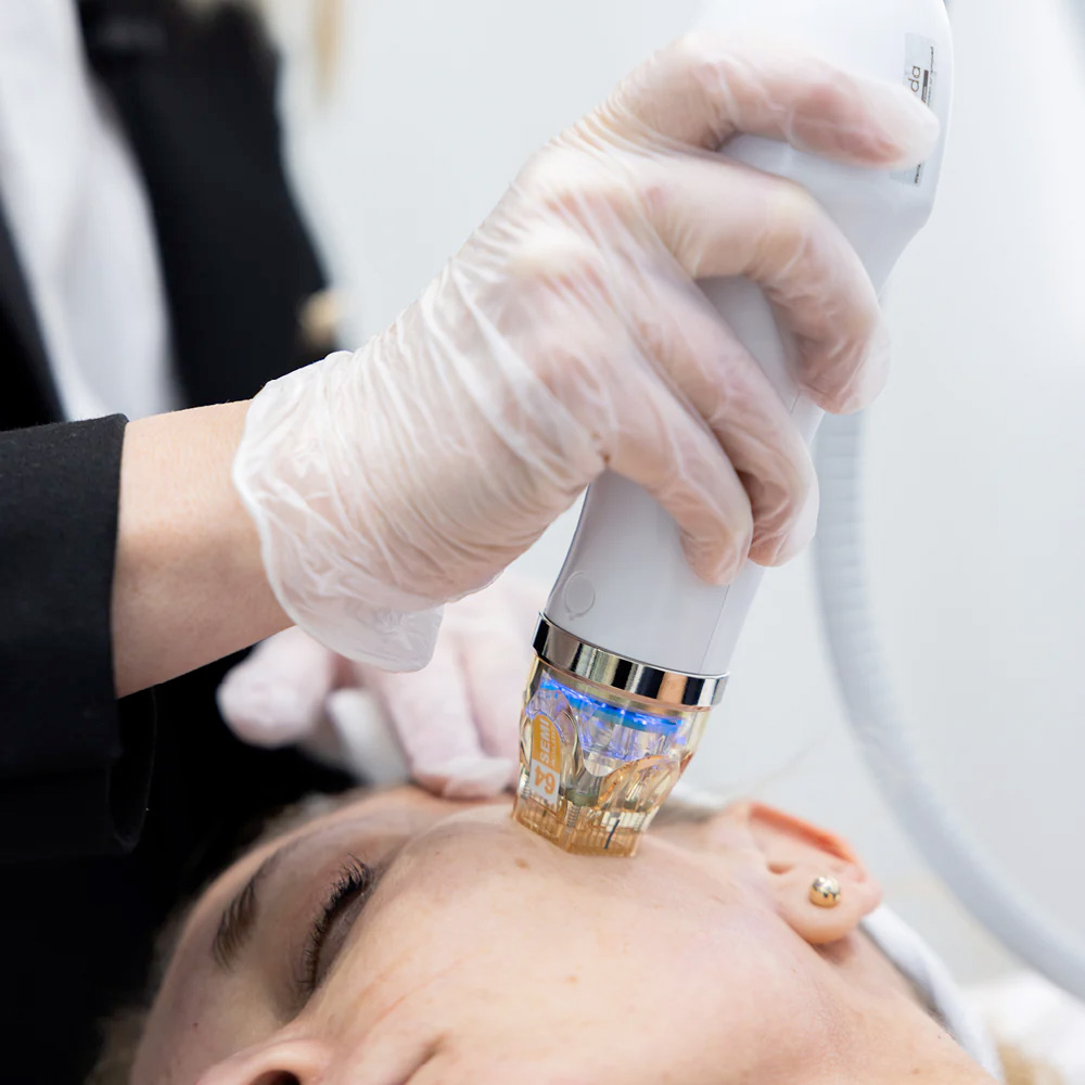 Skin needling: What can it treat, and how does it work?