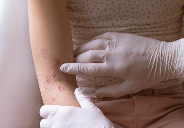 Top 10 Skin Conditions Dermatologists Treat (And What They Can Do for You)